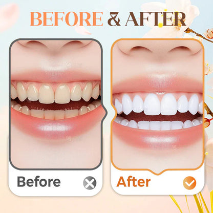 🔥Christmas Limited-Time Offer: 40% OFF!!!🔥120g Fresh Breath & Whitening Toothpaste